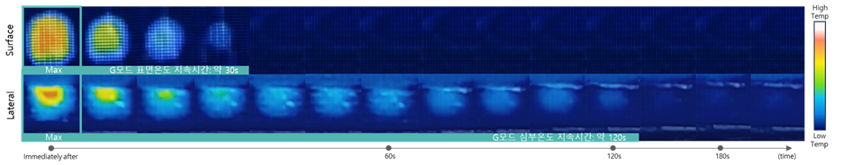 G Mode upper dermis thermal result